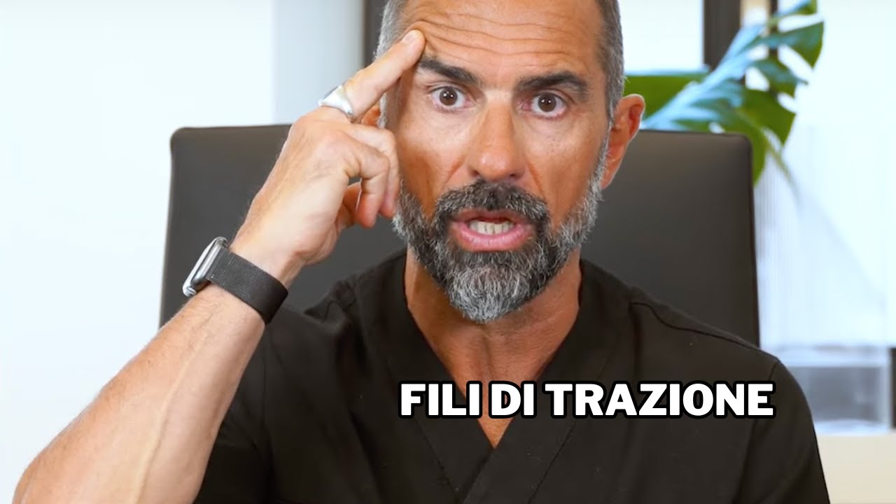Fili di trazione. Funzionano Sono sicuri