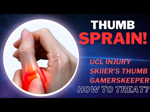 Thumb sprain painful UCL ligament injury