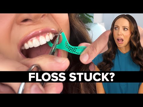 Floss Stuck Between Teeth? Here’s What to Do!