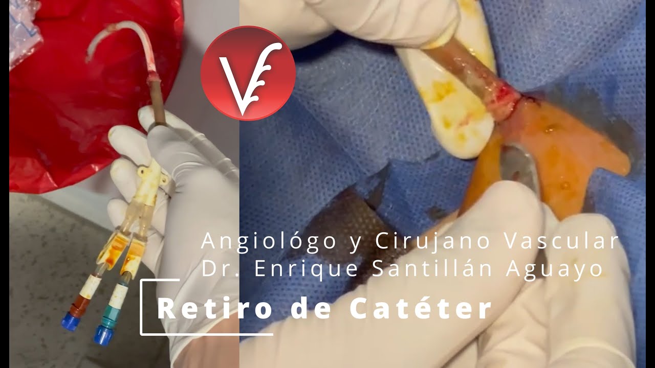 Enrique Santillán Aguayo-35