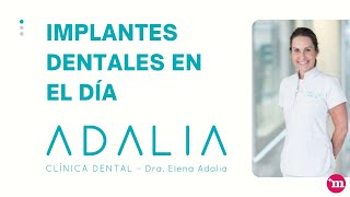 Implantes dentales en el día