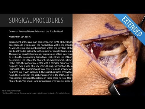 Common Peroneal Nerve Release at the Fibular Head - Extended (Feat. Dr. Mackinnon)