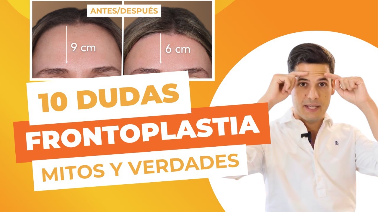 Eloy Condiño Brito-10