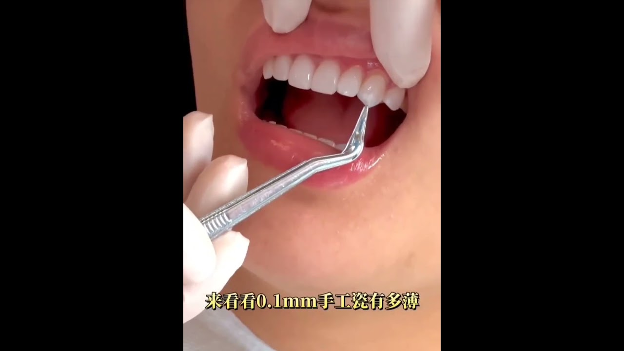 FDA certificated Chinese dental lab looks for USA distributors #dentist #dentalartistry  #smile