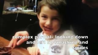 What do seizures look like?