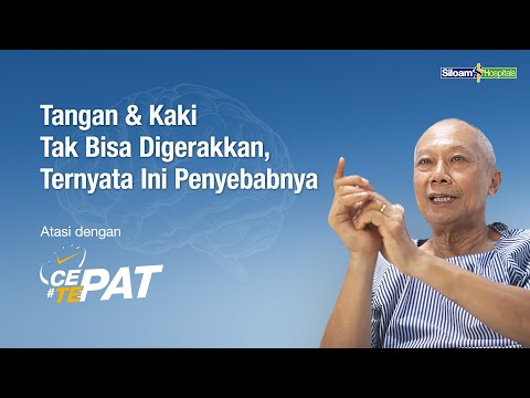Doctor explaining about stroke treatment