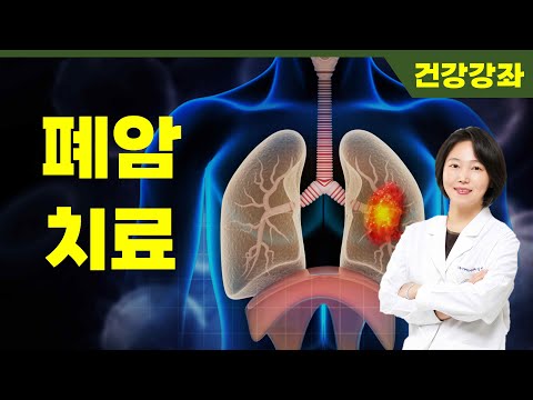 폐암 치료