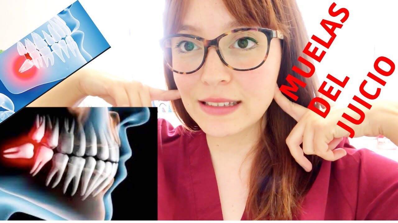 TODO lo que quieres saber sobre las MUELAS DEL JUICIO
