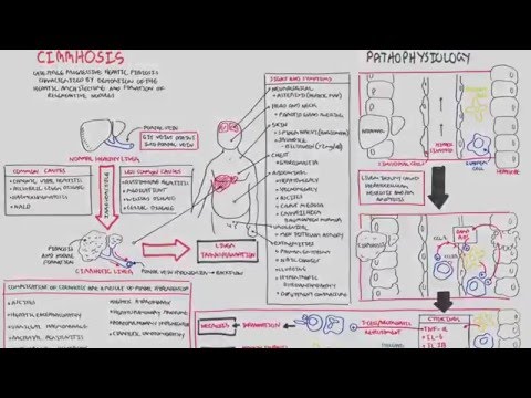 Liver Cirrhosis (SandS, Pathophysiology, Investigations and Management)