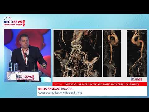 BEC 2021 | Access complications – tips and tricks | Hristo Angelov