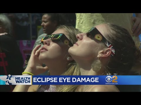 How To Tell If You Suffered Eye Damage During The Eclipse