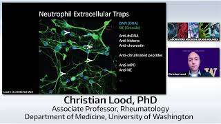 Neutrophils in Inflammation and Autoimmunity