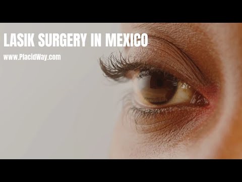 Watch Lasik Surgery  Video in Mexico