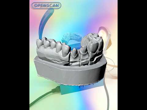 OpenScan Mini - 3D Scanning & Printing an accurate 🫦 Dental Model  #3dprinting #dental #3dscanning