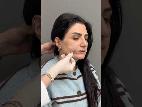 Skin Tightening Treatment