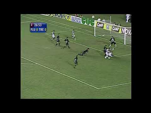 Fluminense 1 x 0 Treze - Copa do Brasil 2005
