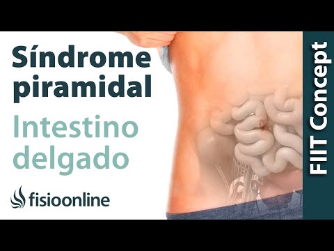 Síndrome del músculo piramidal derecho y su relación con el intestino delgado