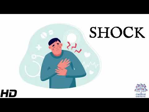 Shock: Everything You Need To Know