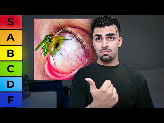 ranking every human pain SDDEFAULT Thumbnail