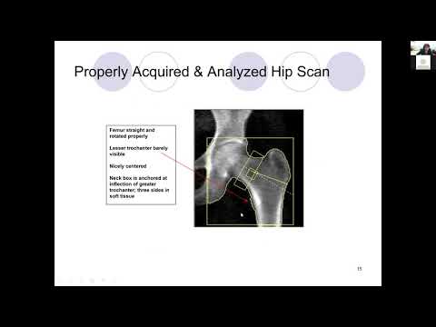 DXA Tech Training - Hologic