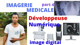 IMAGERIE MÉDICALE part4: Comment Développe t&#39;on les Images en Radiologie? Développeuse VS Numériseur