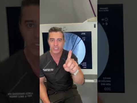 Can I operate on Bunions, with a C-ARM?