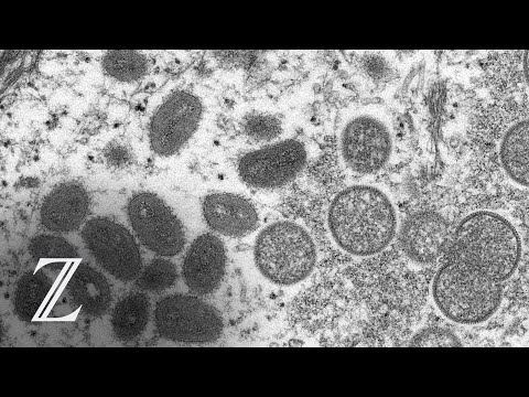 Erster Fall von Affenpocken in Deutschland