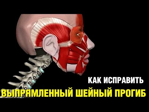 Ортопедические корсет поясничный усиленный Искривление осанки у ребенка видео