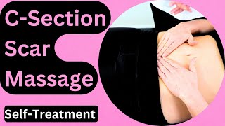 How to Massage your C-section Scar: Easy Technique to Reduce Scarring