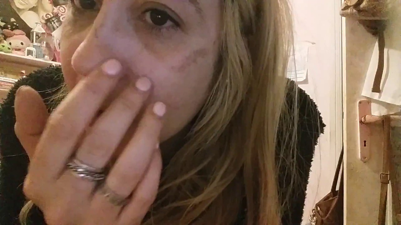 laser macchie scure sul viso ^