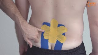 Performance tape, unsteril