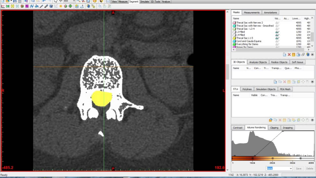 Materialise Mimics and 3Matic Tutorial