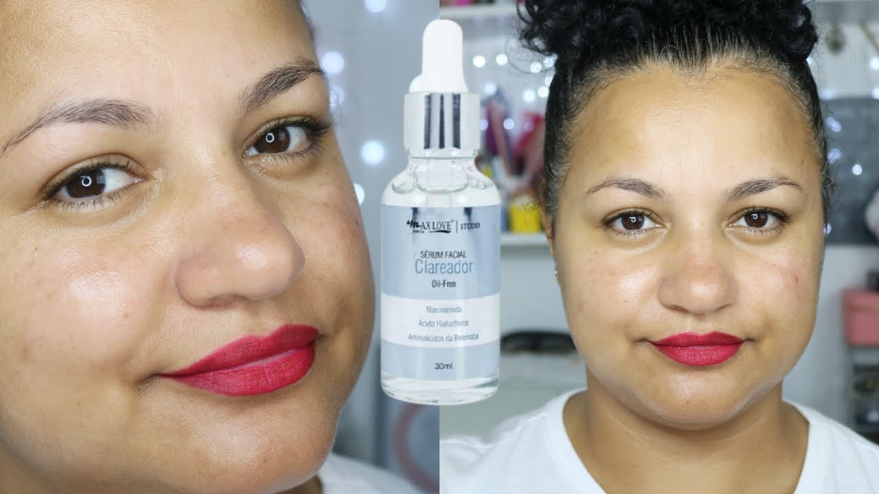 Watch Now CLAREADOR MAX LOVE 😱😱O MELHOR CLAREADOR DE MANCHAS BARATINHO | Minha experiência CLAREADOR MAX LOVE 😱😱O MELHOR CLAREADOR DE MANCHAS BARATINHO | Minha experiência