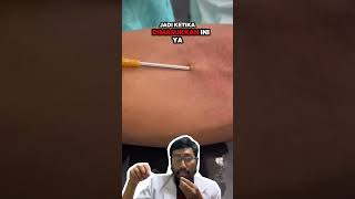 Download lagu Banyak yang masih salah paham tentang infus, WAJIB NONTON! #infus #jaruminfus #faktakesehatan mp3 Download lagu Banyak yang masih salah paham tentang infus, WAJIB NONTON! #infus #jaruminfus #faktakesehatan mp3