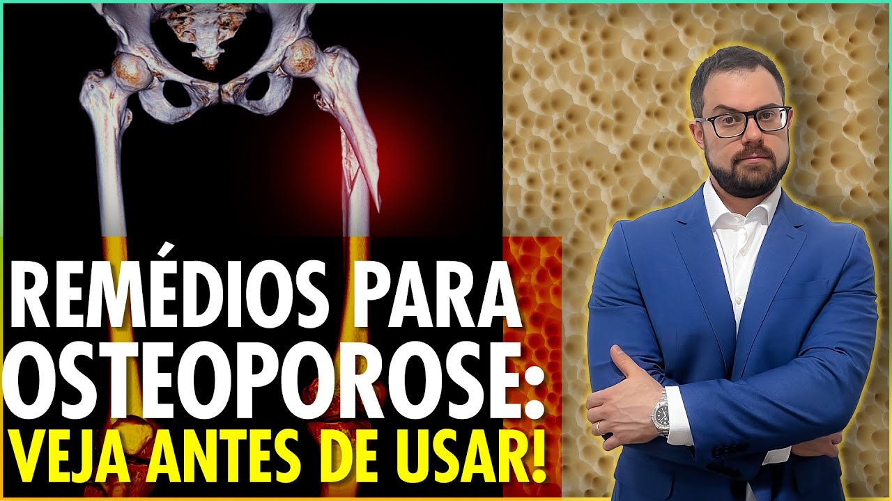 ALENDRONATO | RISENDRONATO | IBANDRONATO: A polêmica dos bifosfonatos orais