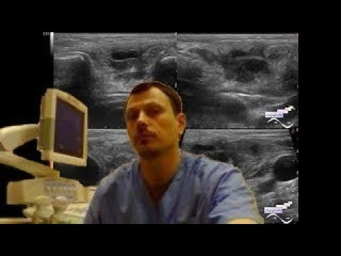 Pediatric Soft tissue ultrasound - Neck lesion