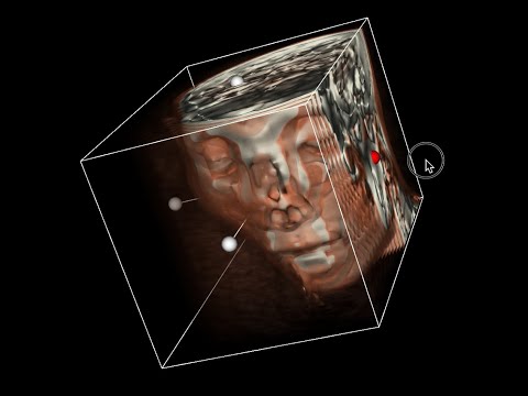 保健学科 VTK の Volume Rendering の機能を MacOS BigSur で試すだけの動画 (VTK Volume Rendering Sample For MacOS BigSur)