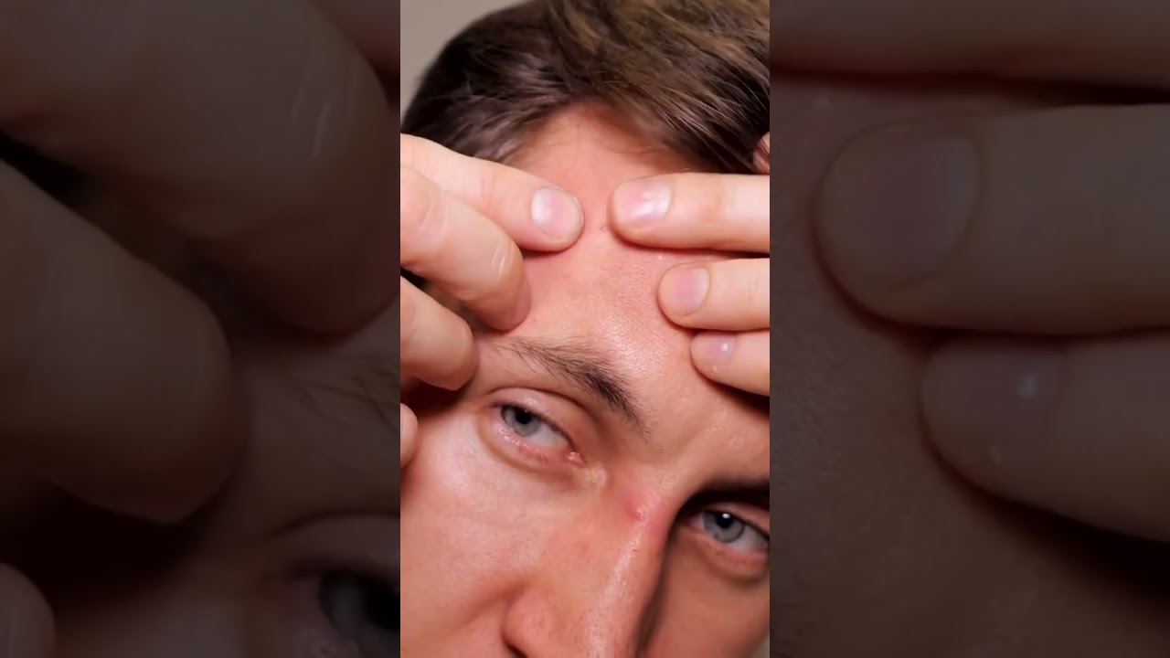 Edmundo Denis Rodriguez-15