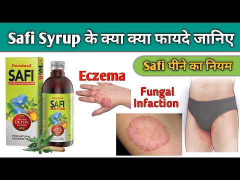 Safi Syrup के क्या क्या फायदे जानिए | Safi Syrup पीने का सही नियम | Safi Syrup Benefits For Eczema