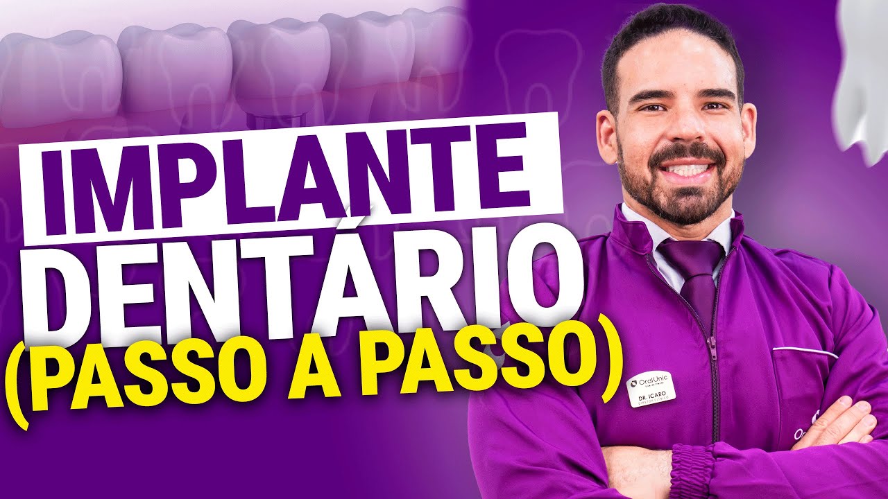 IMPLANTE DENTÁRIO (PASSO A PASSO)