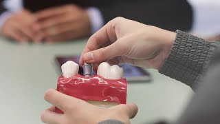 Video de Implantología avanzada