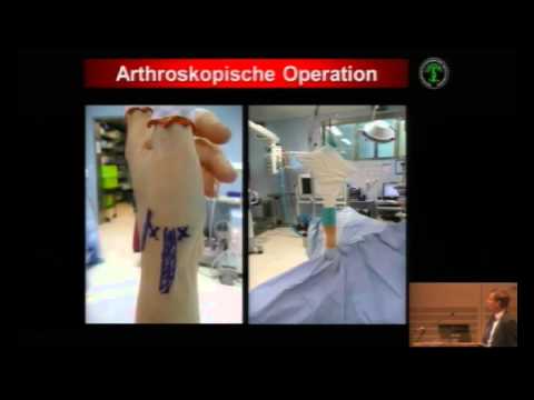 Verstopfung, Rückenschmerzen Wirbelsäulen Behandlung von Osteoarthrose Bewertungen