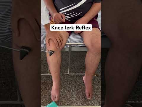 Knee Jerk Reflex (L3-L4), there is exaggerated extension of the left knee #knee #reflexes #reels