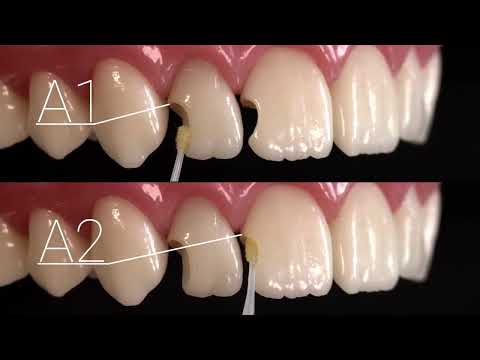 CLEARFIL MAJESTY ES-2 UNIVERSAL, шприц 3,6 г (Kuraray Noritake) - фото 2 - id-p2801454596