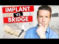 Dental Implants vs Bridges for a Missing Tooth