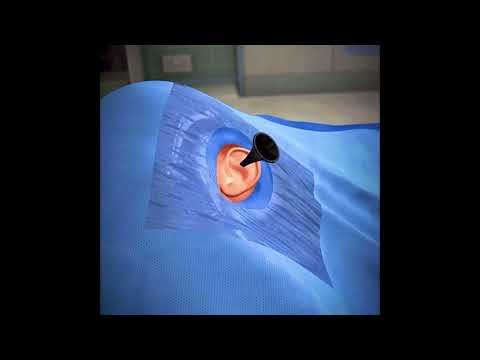 Ear Infection Treatment by Private Algomed Hospital in Adana, Turkey