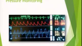 Dr Pierre Janin: Intensive Care Management of Patients After Mitral Valve Surgery