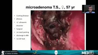 Dr. Sergiu Stoica and Dr. Bogdan Mocanu- live-in-a-box sessions (22.10.2020 - Surgicon Congress)