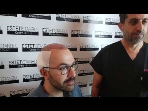 Pianificazione Prima del Trapianto di Capelli - Dr Hamid AYDIN