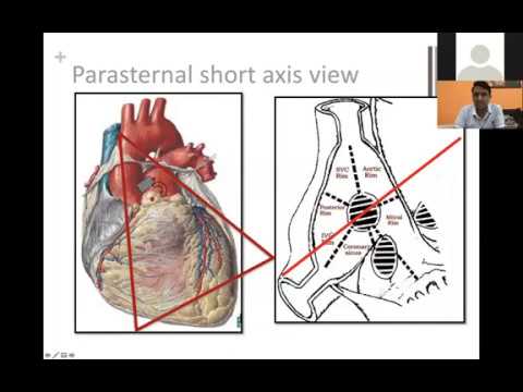 Learn from the Masters - Interventions in Congenital Heart Disease S1: D2 7Apr20